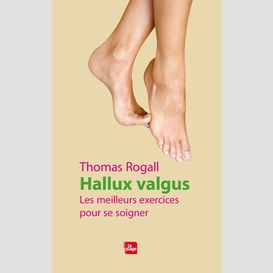 Hallux valgus