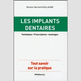 Implants dentaires (les)
