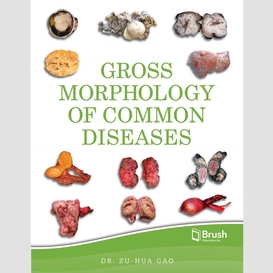 Gross morphology of common diseases