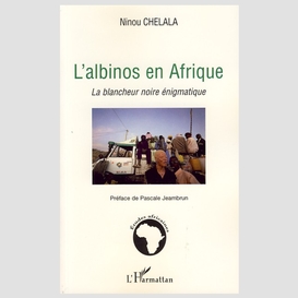 L'albinos en afrique