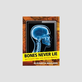 Bones never lie