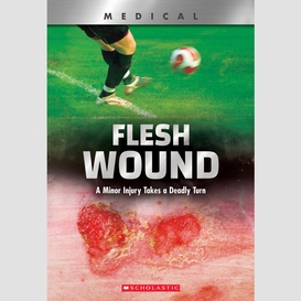 Flesh wound: a minor injury takes a deadly turn (xbooks)