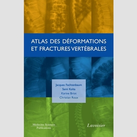 Atlas des déformations et fractures vertébrales