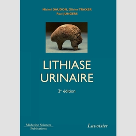 La lithiase urinaire