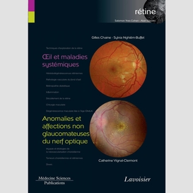 Rétine volume 5, oeil et maladies systémiques anomalies et affections non glaucomateuses du nerf optique