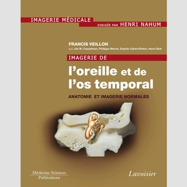 Imagerie de l'oreille et de l'os temporal volume 1, anatomie et imagerie normales