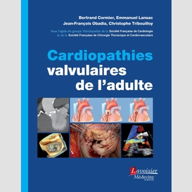 Cardiopathies valvulaires de l'adulte