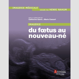 Imagerie du foetus au nouveau-né