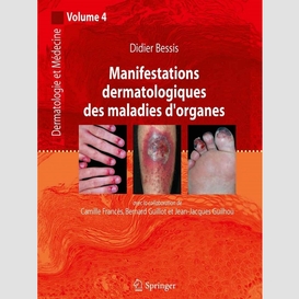 Dermatologie et médecine volume 4, manifestations dermatologiques des maladies d'organes