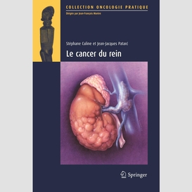 Le cancer du rein