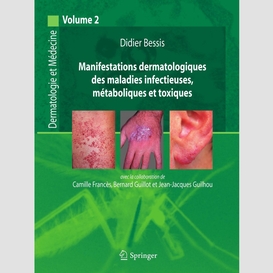Dermatologie et médecine volume 2, manifestations dermatologiques des maladies infectieuses, métaboliques et toxiques