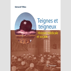 Teignes et teigneux : histoire médicale et sociale