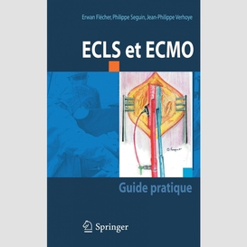 Ecls et ecmo : guide pratique